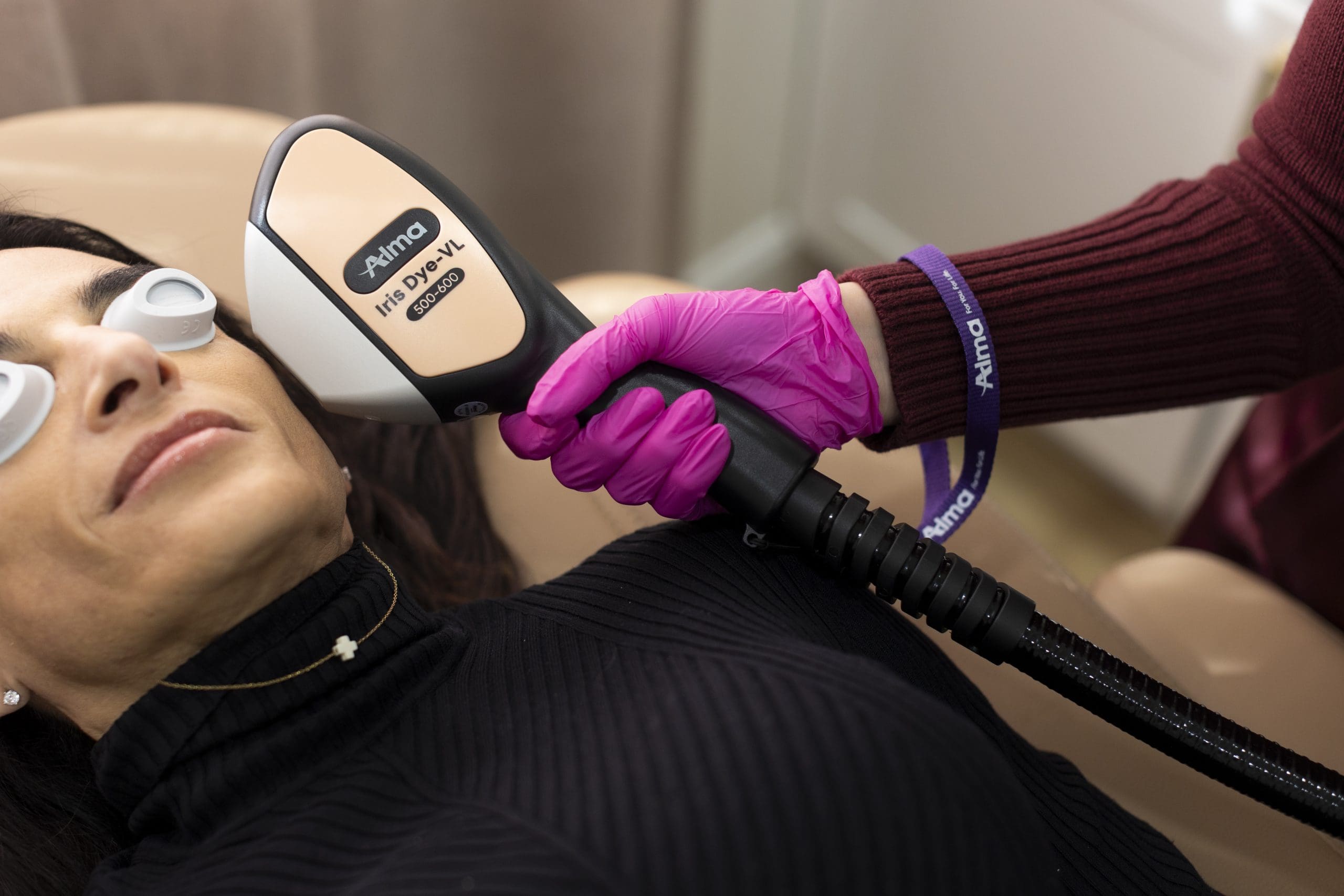 alma dye vl ipl brandon fl