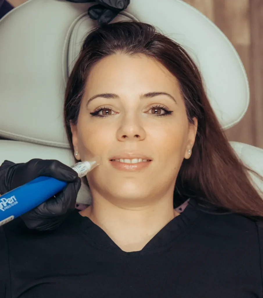A woman lies in a treatment chair while a gloved hand holds a skinpen microneedling pen near her lips, with a padded headrest behind her.